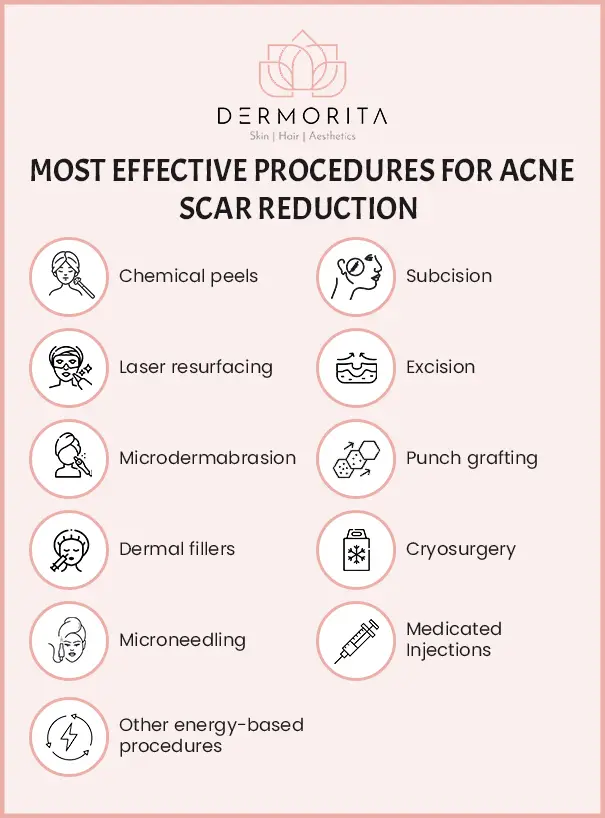 Most Effective Procedures for Acne Scar Reduction Most effective procedures for acne scar treatment in South Delhi include chemical peels, laser resurfacing, microdermabrasion, dermal fillers, and more.