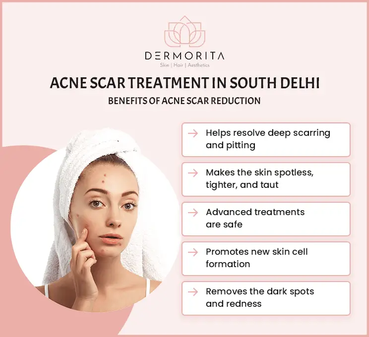 Benefits of Acne Scar Reduction Acne Scar Treatment in South Delhi: The benefits of acne scar reduction include helping resolve deep scarring and pitting, making skin spotless, and more.