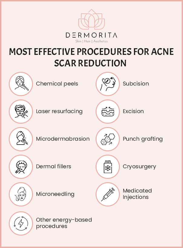 Most effective procedures for acne scar treatment in South Delhi include chemical peels, laser resurfacing, microdermabrasion, dermal fillers, and more.