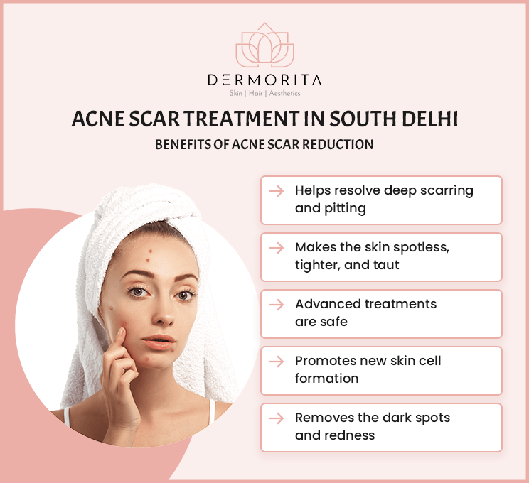 Acne Scar Treatment in South Delhi: The benefits of acne scar reduction include helping resolve deep scarring and pitting, making skin spotless, and more.