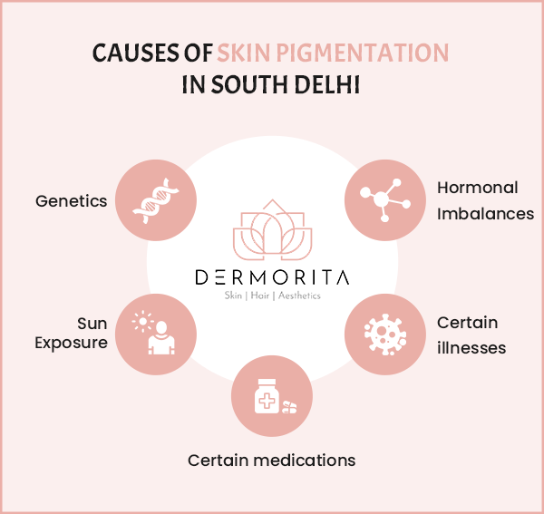 Causes Skin Pigmentation in South Delhi : Genetics, Hormonal imbalances, Sun exposure, Certain medications, Certain illnesses.
