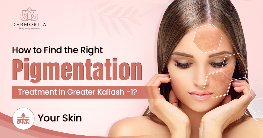 How to Find the Right Pigmentation Treatment in Greater Kailash for Your Skin