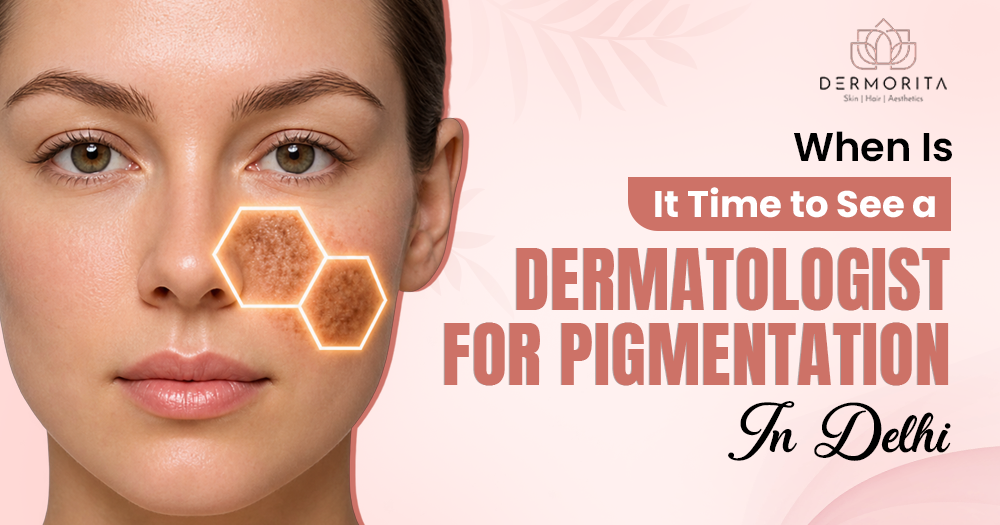 When Is It Time to See a Dermatologist for Pigmentation in Delhi